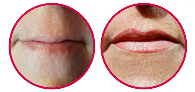 Mit Permanent Make-up behandelte Lippen einer Dame im mittleren Alter, inclusive Randzeichnung.