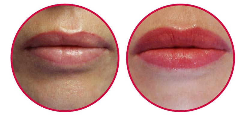 Ein weiteres Beispiel von Lippen, die einer Permanent Make-up Behandlung unterzogen wurden.