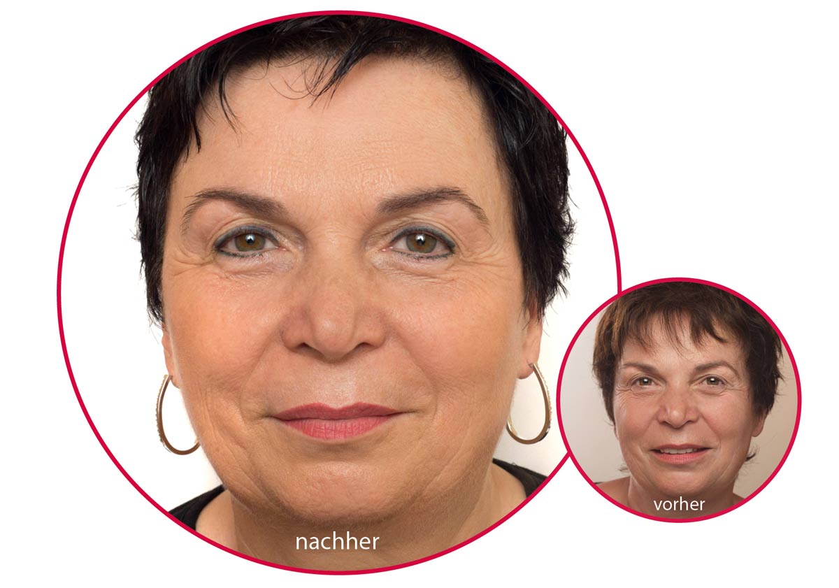 Ältere Dame mit Permanent Make-up an der Augenpartie.